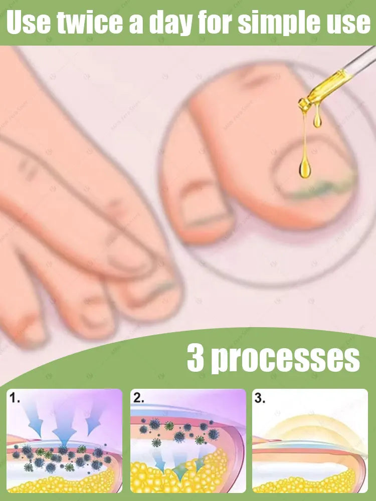 Technology changes lives,Rejuvenator - Fungus Prevention Technology - Adjustable Control & Safety Sensor