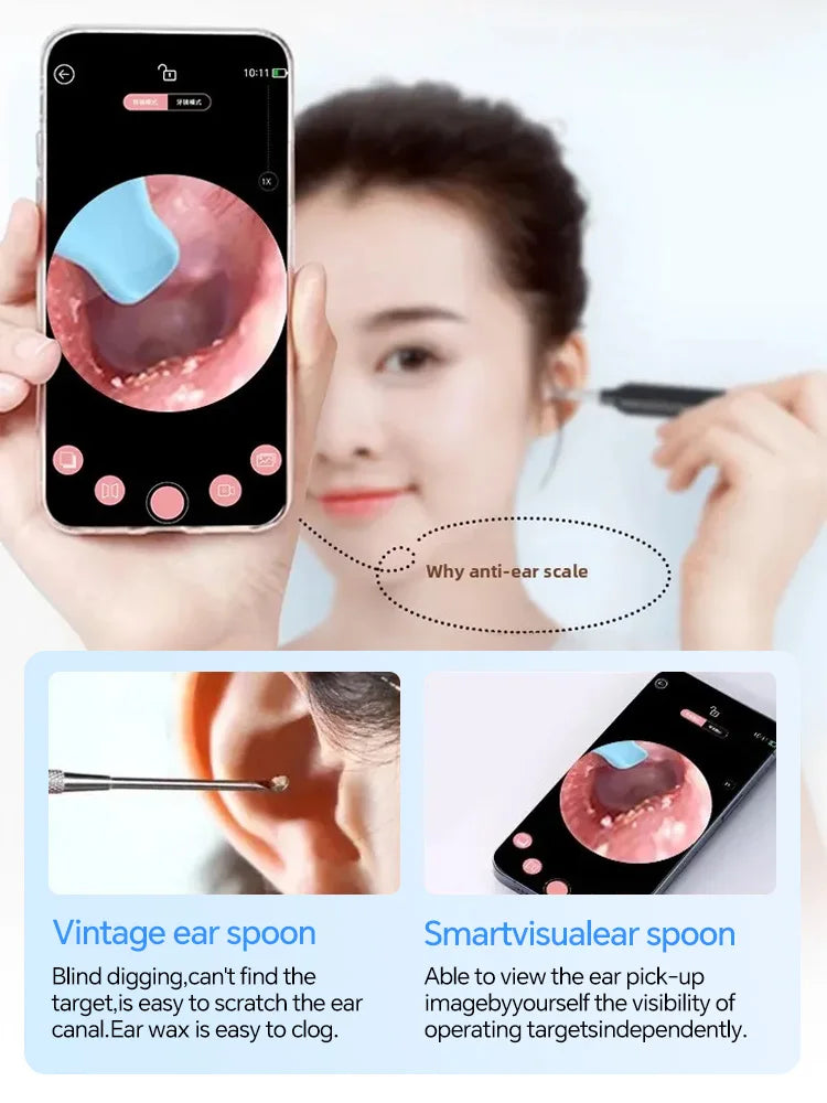 Generation-2,Visual Ear Wax Cleaner Camera Safe Earwax Removal Endoscope Ear Cleaning Tools Ear Care,Black,white styles,Hot sale