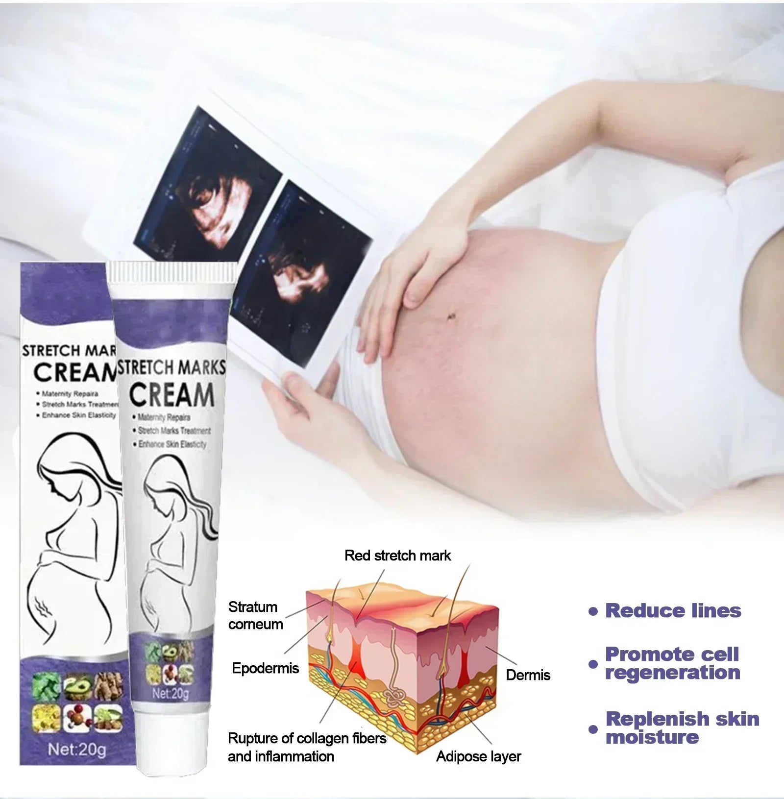 Stretch Mark Vanishing Cream Remove Body Buttock Breast Marks Effective Repair Maternity Loose Firming Skin Care